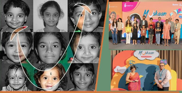 Himalaya’s Muskaan Initiative Brings the Message of Hope to Ahmedabad to Expand Access to Cleft Care